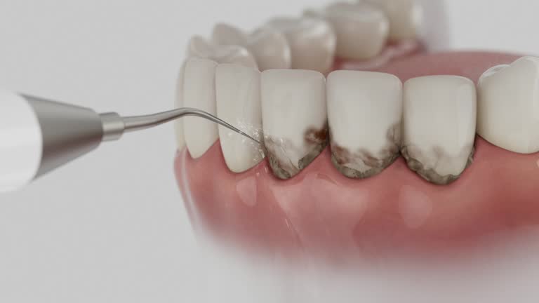 Reliable Emergency Dentist contractor in Stowell, TX by Smile Center Dentistry